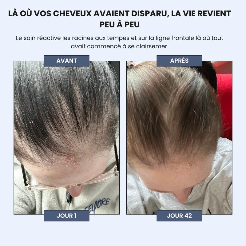 Sérum Roll-on Cheveux