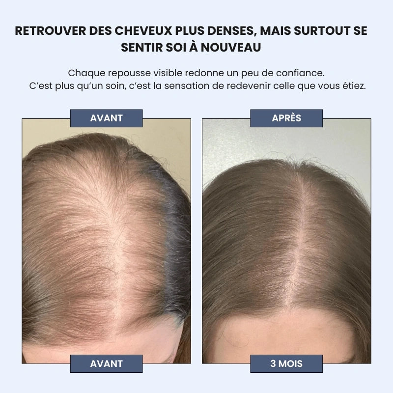Sérum Roll-on Cheveux