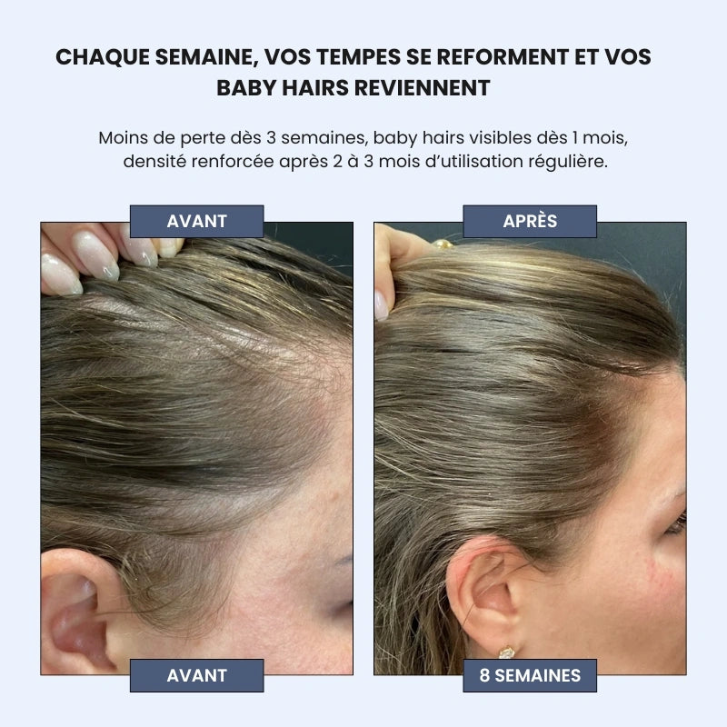 Sérum Roll-on Cheveux