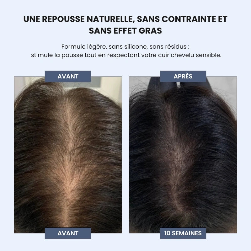 Sérum Roll-on Cheveux
