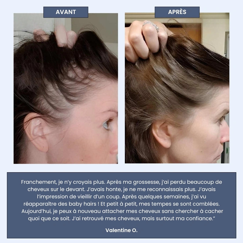 Sérum Roll-on Cheveux