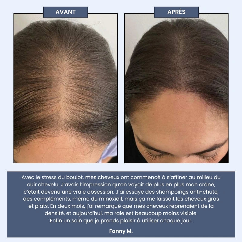 Sérum Roll-on Cheveux