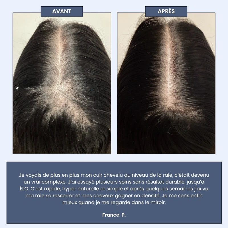 Sérum Roll-on Cheveux