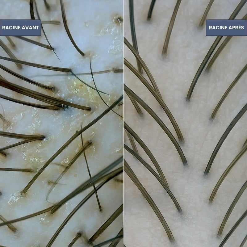 Sérum Roll-on Cheveux